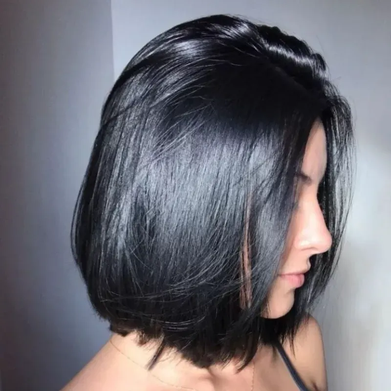 Tratamientos Faciales